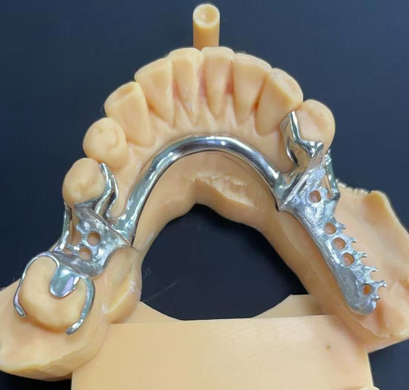 مزايا إطار عمل الكوبالت والكروم (إطار Co Cr)