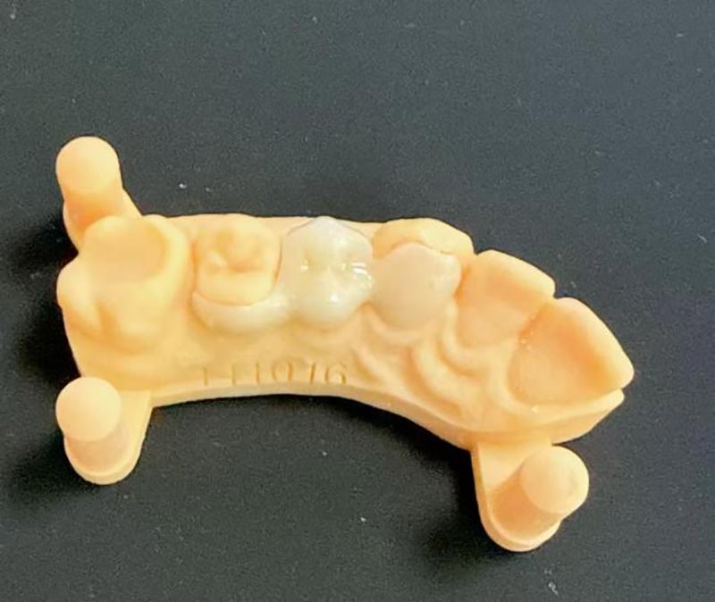 ما تحتاج لمعرفته حول ميريلاند بريدجز؟