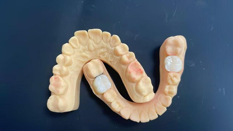 ما هي حافة الكتف؟