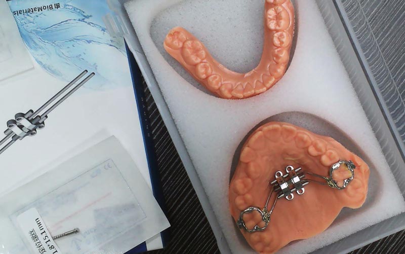 فهم توسع الهيكل العظمي MSE مع مختبر WM لطب الأسنان