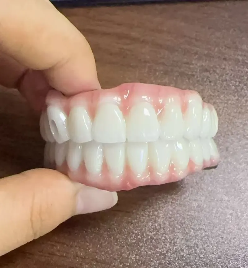 مخاطر سوء الإطباق