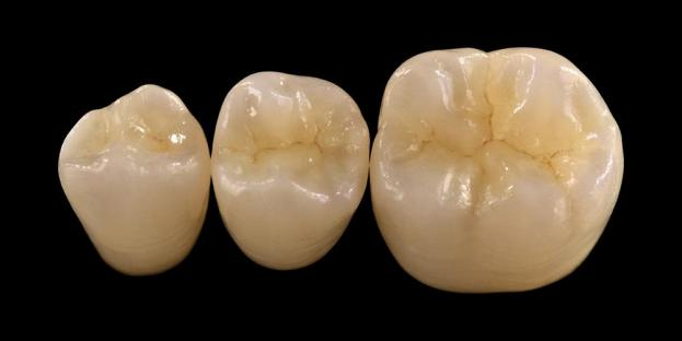 <h2>الزركونيا في طب الأسنان: المؤشرات والمزايا والاعتبارات السريرية</h2>
<p>الزركونيا معروفة على نطاق واسع بقوتها ومتانتها. توفر أحدث أجيال مواد الزركونيا أيضًا خصائص جمالية محسنة بشكل ملحوظ. بالنسبة للمرضى الذين يفكرون في الترميمات الخزفية بالكامل، من الضروري إجراء تقييم دقيق لكل من مؤشرات وقيود الأنظمة المعتمدة على الزركونيا.</p>
<p>يتوقع مرضى اليوم بشكل متزايد عمليات ترميم تجمع بين الجماليات الممتازة والأداء الوظيفي الكامل. يمكن لمعظم أنظمة السيراميك الحديثة تلبية هذه التوقعات، لكن النجاح السريري يعتمد إلى حد كبير على اختيار المواد المناسبة وإعداد الأسنان وبروتوكولات التثبيت. وينبغي أن يسترشد الاختيار بخصائص المواد الرئيسية مثل مقاومة الكسر، وقوة الانثناء، ومقاومة التآكل، والاستقرار على المدى الطويل. ومن بين هذه المواد، أصبحت الزركونيا واحدة من أكثر الخيارات المستخدمة على نطاق واسع في طب الأسنان الترميمي المعاصر.</p>
<h3>لماذا تختار زركونيا؟</h3>
<p>تُقدر قيمة الزركونيا بقوتها الاستثنائية ومتانتها على المدى الطويل. تختلف الزركونيا الحديثة بشكل كبير عن الأجيال السابقة، والتي كانت أكثر غموضًا وأقل جمالية. اليوم، تتيح تقنية CAD/CAM التصنيع الدقيق لترميمات الزركونيا مع خصائص بصرية محسنة.</p>
<p>يمكن تصميم عمليات الترميم على النحو التالي:</p>
<ul>
<li><strong>زركونيا متجانسة:</strong>مثالية للتيجان والجسور الخلفية، وتوفر قوة ومتانة عالية.</li>
<li><strong>زركونيا الطبقات:</strong>مناسب للحالات التي تتطلب جماليات محسنة، بما في ذلك الترميمات طويلة المدى عبر مناطق مختلفة من الفم.</li>
</ul>
<p>تختلف قوة الانثناء اعتمادًا على النوع، حيث تتراوح من حوالي 590 ميجا باسكال في الزركونيا عالية الشفافية إلى ما يصل إلى 1400 ميجا باسكال في الأشكال المتجانسة. يمكن تدعيم ترميمات الزركونيا باستخدام أسمنت راتنجي ذاتي اللصق أو أسمنت أيونومر زجاجي معدل بالراتنج.</p>
<h3>العوامل الرئيسية في اختيار مادة الزركونيا</h3>
<p>عند النظر في الزركونيا لترميم السيراميك بالكامل، يجب على الأطباء تقييم عدة عوامل حاسمة:</p>
<ul>
<li>بنية الأسنان المتبقية</li>
<li>الموقع في تجويف الفم (المنطقة الجمالية مقابل المنطقة الوظيفية)</li>
<li>وجود عادات غير وظيفية مثل صريف الأسنان</li>
<li>شفافية الأسنان الطبيعية المجاورة</li>
<li>لون وحالة بنية الأسنان الأساسية</li>
</ul>
<p>تشمل المنطقة الجمالية عادةً الأسنان الأمامية، على الرغم من أنها قد تمتد في بعض المرضى إلى الضرس الأول اعتمادًا على خط الابتسامة وديناميكيات الوجه. تشتمل المنطقة الوظيفية عمومًا على الضواحك والأضراس، حيث تكون قوى الإطباق أعلى بكثير.</p>
<h3>تطبيقات المنطقة الوظيفية</h3>
<p>في المناطق الخلفية، يجب النظر بعناية في قوى الإطباق. تعتبر الزركونيا بديلاً ممتازًا لترميمات PFM التقليدية، خاصة في الحالات ذات المساحة الترميمية المحدودة. تسمح الزركونيا المتجانسة الحديثة بتصميم محيط كامل لتشريح الإطباق، بما في ذلك الشرفات الوظيفية والحواف الهامشية، مع الحفاظ على القوة العالية.</p>
<p>تظهر الأدلة الحالية أن الزركونيا المتجانسة مناسبة تمامًا للتيجان الخلفية والجسور متعددة الوحدات نظرًا لمقاومتها الممتازة للكسر والتآكل. كما أدى التقدم في تقنيات اللصق وتصميم التحضير إلى تحسين النتائج السريرية على المدى الطويل.</p>
<h3>تطبيقات المنطقة الجمالية</h3>
<p>في المنطقة الأمامية، يجب أن تحاكي عمليات الترميم لون الأسنان الطبيعي، والشفافية، وسلوك الضوء. في حين أن المواد مثل ديسيليكات الليثيوم توفر جماليات ممتازة، إلا أنها أقل قوة وتتطلب عادةً روابط لاصقة.</p>
<p>الميزة الرئيسية للزركونيا هي قدرتها على التثبيت بشكل تقليدي مع تحقيق أداء جمالي عالٍ. مع تطور أنظمة الزركونيا عالية الشفافية ومتعددة الطبقات، أصبح من الممكن الآن إنتاج ترميمات تحاكي الأسنان الطبيعية بشكل وثيق.</p>
<p>تعمل تقنيات المعالجة المتقدمة على تعزيز الخصائص البصرية وتقليل العيوب التي قد تؤثر على انتقال الضوء ومظهره.</p>
<h3>القوة والجماليات مجتمعة</h3>
<p>أعطت أنظمة الزركونيا المبكرة الأولوية للقوة ولكنها افتقرت إلى الجودة الجمالية. تجمع الزركونيا المتجانسة الحديثة بنجاح بين القوة والمظهر المحسن، مما يجعلها مناسبة لمجموعة واسعة من الحالات السريرية.</p>
<p>وهو مفيد بشكل خاص للمرضى الذين يعانون من عادات غير وظيفية أو حالات فشل الترميم السابقة. تشير الدراسات السريرية إلى ارتفاع قبول المريض وانخفاض معدلات المضاعفات.</p>
<p>تم تقليل المخاوف المتعلقة بتآكل الأسنان المتعارضة باستخدام تركيبات أحدث. تظهر أسطح الزركونيا المصقولة بدرجة عالية إمكانية كاشطة منخفضة، وفي بعض الحالات قد تكون ألطف من الترميمات التقليدية المصنوعة من البورسلين المندمج بالمعدن.</p>
<h3>زراعة الزركونيا: البديل الناشئ</h3>
<p>في حين تظل غرسات التيتانيوم هي المعيار السريري، فإن غرسات الزركونيا تحظى بالاهتمام كبديل خالٍ من المعادن. كانت التصميمات المبكرة في المقام الأول عبارة عن أنظمة مكونة من قطعة واحدة، ولكن غرسات الزركونيا المكونة من قطعتين تسمح الآن بتحسين مرونة الأطراف الاصطناعية.</p>
<p>تعتبر غرسات الزركونيا مفيدة بشكل خاص في الحالات التي توجد فيها مخاوف جمالية، مثل احتمال تغير اللون الرمادي للأنسجة المحيطة بالزرعة أو النمط الحيوي اللثوي الرقيق. ويمكن أيضًا أخذها في الاعتبار للمرضى الذين يعانون من حساسية نادرة للتيتانيوم.</p>
<p>ومع ذلك، لا تزال غرسات الزركونيا جديدة نسبيًا، وتظل البيانات السريرية طويلة المدى محدودة مقارنة بأنظمة التيتانيوم.</p>
<h3>خاتمة</h3>
<p>لقد تطورت الزركونيا إلى مادة متعددة الاستخدامات للغاية في طب الأسنان الترميمي، مما يوفر توازنًا قويًا بين الأداء الميكانيكي والجماليات. يعد الاختيار المناسب للحالة والالتزام بالبروتوكولات السريرية أمرًا ضروريًا لتحقيق النتائج المثلى في كل من التطبيقات الأمامية والخلفية.</p>