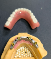 محدد المواقع وشريط الأسنان