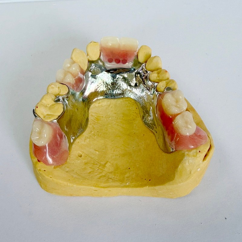 إطار الاستعادة الجزئي القابل للإزالة